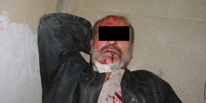 Un preso con graves heridas en la garganta (SBS).