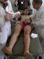 Un iraquí herido recibe atención médica después de una explosión. (Efe)