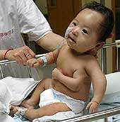 Jie Jie, el bebé chino que nació con tres brazos, ha sido intervenido con éxito. (AP Photo)