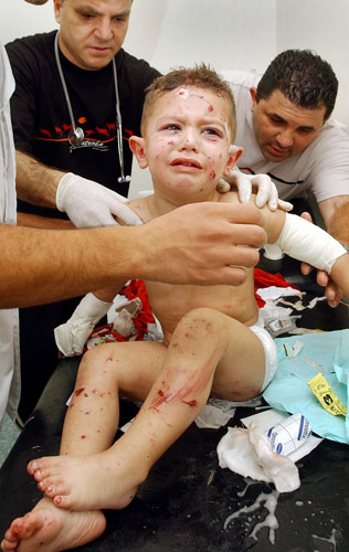 170706 Niño herido por Israel