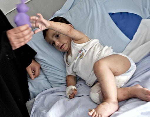 180706 Niño herido en el Líbano