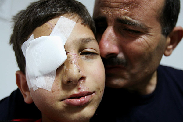 030806 Niño herido en el Líbano