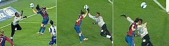 Varias imágenes de la mano de Messi. (Canal +)