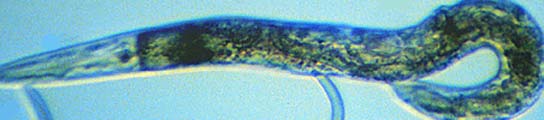 Lombriz intestinal:Caenorhabditis elegans