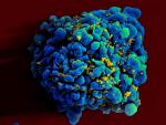Escaneo electromicrogr&aacute;fico de una c&eacute;lula T infectada con VIH