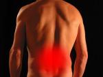 La lumbalgia es el dolor de espalda m&aacute;s com&uacute;n.