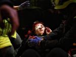 Una joven, herida con una pelota de goma en las protestas contra la detenci&oacute;n de Pablo Hasel en Barcelona.