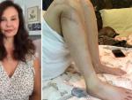 Ashley Judd y una imagen de su pierna derecha.