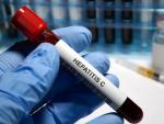 El cribado de la hepatitis C se duplica cuando se piden las pruebas con antelaci&oacute;n