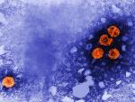 Imagen de microscop&iacute;a electr&oacute;nica de transmisi&oacute;n coloreada digitalmente revela la presencia de viriones de la hepatitis B (de color naranja).