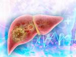 Virus attack in human liver. 3d illustration
