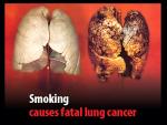 La segunda imagen m&aacute;s impactante fue esta de dos pulmones, uno sano y otro de un fumador, con el lema &quot;Fumar provoca c&aacute;ncer mortal de pulm&oacute;n&quot;.