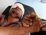 Herido en uno de los atentados del d&iacute;a en Irak (AP)