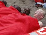 Este inmigrante albino ha llegado a la playa de la Tejita (Tenerife) junto a otros 60 inmigrantes que sufr&iacute;an hipotermia.