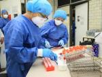 Muestras del virus de la gripe porcina en un laboratorio.