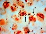 La bacteria 'Legionella pneumophilia' vista a trav&eacute;s de un microscopio.