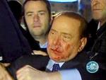 Este aspecto presentaba el exprimer ministro italiano cuando fue agredido por un joven con una estatuilla tras un mitin en la plaza del Duomo (Milan), el 13 de diciembre de 2009.