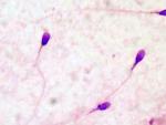 Espermatozoides vistos al microscopio.