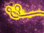 Imagen del virus del &Eacute;bola bajo el microscopio.