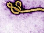 Imagen facilitada por el Centro para el Control y Prevenci&oacute;n de Enfermedades (CDC) estadounidense que muestra el virus del &Eacute;bola.