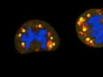<p>Células en división con el material genético en azul y las mitocondrias en rojo. Durante este proceso, las mitocondrias se van dañando (señales amarillas) haciendo que la energía de las células dependa sobre todo de la glucosa.</p>