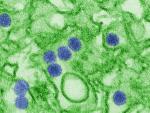 Imagen al microscopio del virus del Zika.
