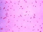 La bacteria Neisseria gonorrhoeae o gonococo de la gonorrea, al microcospio.