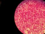 Una imagen microsc&oacute;pica de la gonorrea.