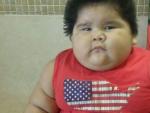Con solo diez meses, Luis Manuel pesa 28 kilos y es porque padece obesidad perinatal por inflamaci&oacute;n celular derivada de una deficiencia de grasas en la sangre y la leche materna.