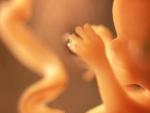 Imagen de un feto humano.