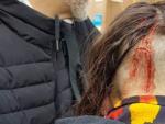 Un manifestante, herido en Drassanes.