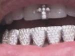 Kim Kardashian comparti&oacute; una foto de su nueva dentadura.