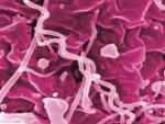 Treponema pallidum, bacteria de la s&iacute;filis