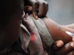 Un ni&ntilde;o recibe una vacuna contra el sarampi&oacute;n en un campamento de desplazados de la Rep&uacute;blica Democr&aacute;tica del Congo, en una imagen de archivo.