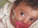 Matilde, la beb&eacute; portuguesa de dos meses que sufre atrofia muscular espinal de tipo 1.