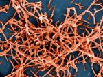 Partículas del virus ébola