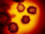 Imagen tomada a trav&eacute;s de un microscopio de c&eacute;lulas del nuevo coronavirus que han sido aisladas de un paciente.