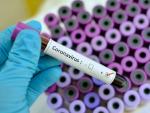 Muestras de sangre para detectar el coronavirus.