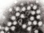 Part&iacute;culas de norovirus, al microscopio.
