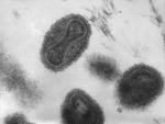 Imagen al microscopio del virus de la viruela.