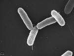 Imagen al microscopio de Salmonella enterica serovar Typhimurium.
