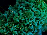 Imagen al microscopio de una c&eacute;lula (colorizada en verde) infectada por part&iacute;culas virales de la variante brit&aacute;nica (amarillo).
