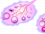 La anovulaci&oacute;n se produce cuando el ovarios no puede madurar y liberar el &oacute;vulo.