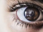 La aniridia es la ausencia total o parcial del iris del ojo.