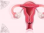 El riesgo de una mujer de padecer cáncer ovárico durante el transcurso de su vida es de aproximadamente 1 en 78.