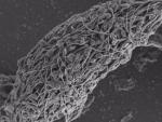 Micrografía electrónica de barrido de espermatozoides humanos pegados e inmovilizados por un anticuerpo antiespermático.