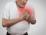 Un estudio demuestra la utilidad de la resonancia magn&eacute;tica card&iacute;aca en pacientes con infarto agudo de miocardio