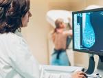 Las mamograf&iacute;as ayudan en la detecci&oacute;n temprana del c&aacute;ncer de mama.