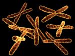 El S&iacute;ndrome Turner ocurre cuando falta un cromosoma X.