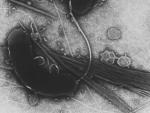 Vibrio cholerae, la bacteria causante del c&oacute;lera.